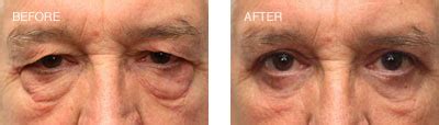 graystone eye aesthetics.